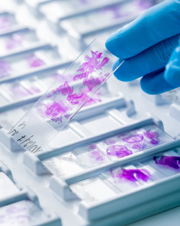 Informații pentru clinici colaboratoare și transmiterea probelor la Oncodiagnostic Maris Anapat